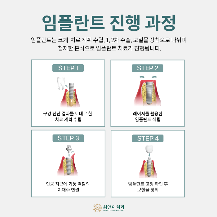 치아를 상실했을 때, 기능을 회복시켜주는 임플란트 관련 이미지 6