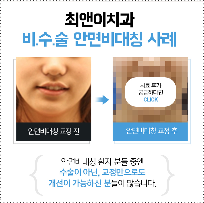 최앤이치과 달라지고 싶다면 관련 이미지 4