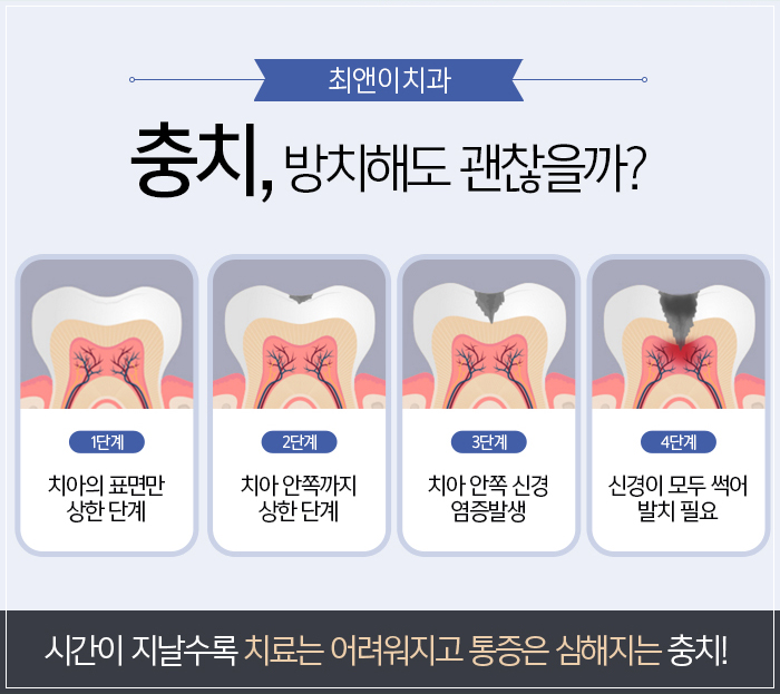 을지로입구역치과 나만을 위해서 관련 이미지 7