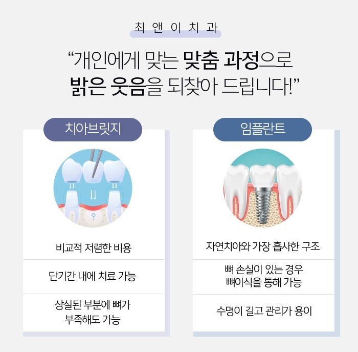 앞니브릿지비용 알아보는 이유는 관련 이미지 7