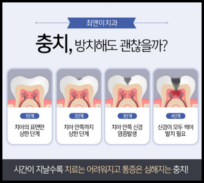 치아보철치료 늦지 않아야 해요! 관련 이미지 6