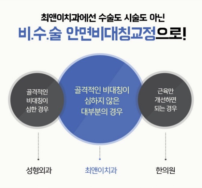 안면비대칭수술 불안하다면 관련 이미지 4
