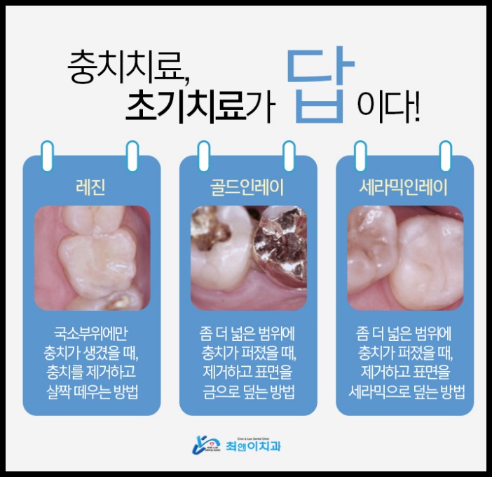 크라운치료가격 힘들지 않아야죠 관련 이미지 4