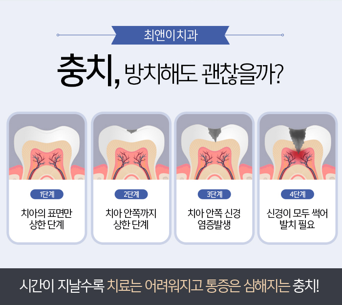 이빨깨짐 조심스럽다면 관련 이미지 2