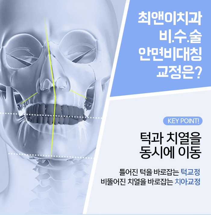 턱비대칭교정 망설이고 있나요? 관련 이미지 7