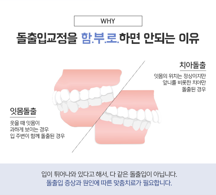 돌출입의 정의와 진단하는 방법에 대해 관련 이미지 5