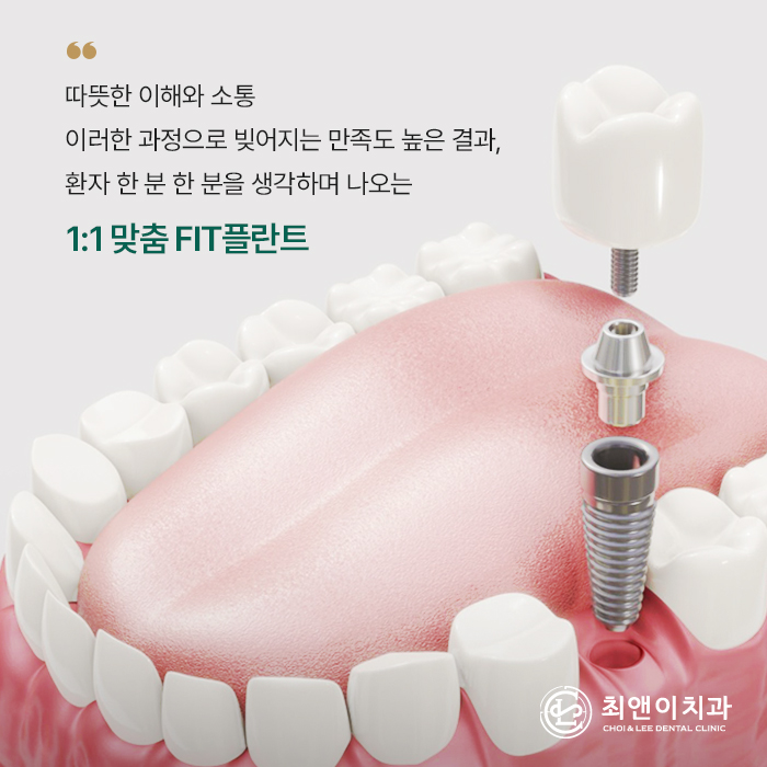 치아를 상실했을 때, 기능을 회복시켜주는 임플란트 관련 이미지 24