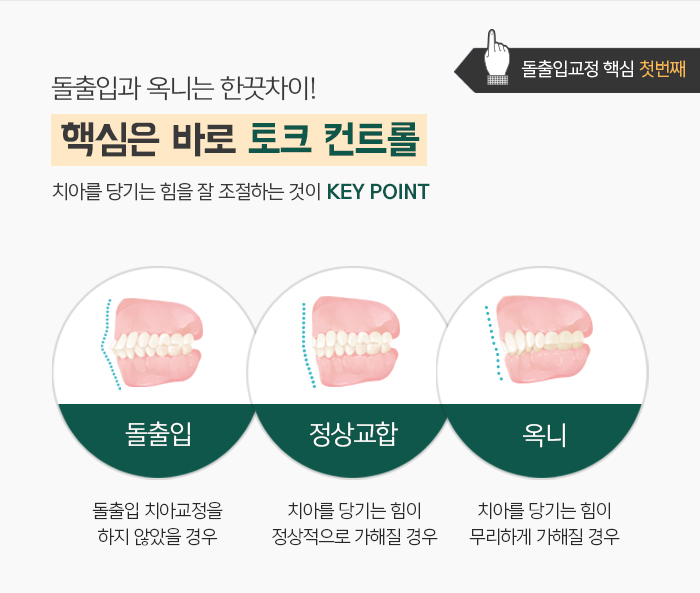 돌출입의 정의와 진단하는 방법에 대해 관련 이미지 9