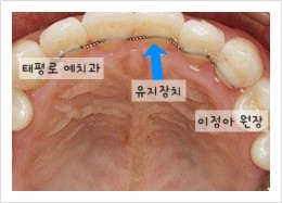 [치아교정] "치아교정과 치아 재교정" 방송일정~ 관련 이미지 3
