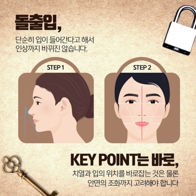 잇몸뼈돌출 치아가 원인이라면 관련 이미지 6