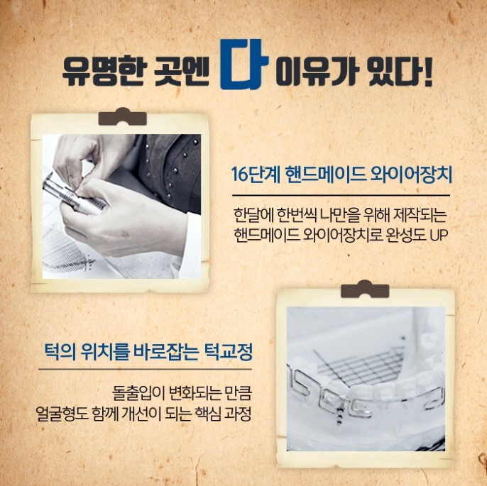 잇몸뼈돌출 치아가 원인이라면 관련 이미지 8