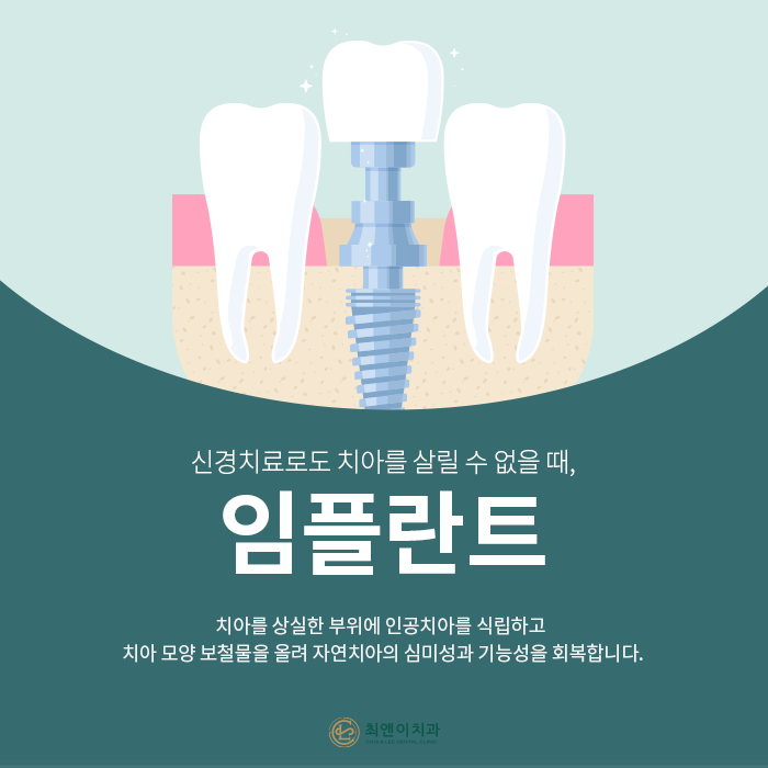 자연치아를 보존하기 위한 충치치료 방법 관련 이미지 9