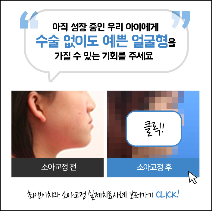 초등학생치아교정 초기에 잡아야 해요 관련 이미지 5
