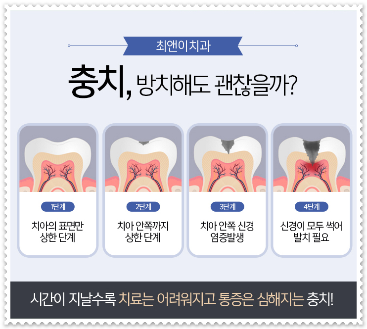 앞니깨짐 걱정이 된다면? 관련 이미지 9