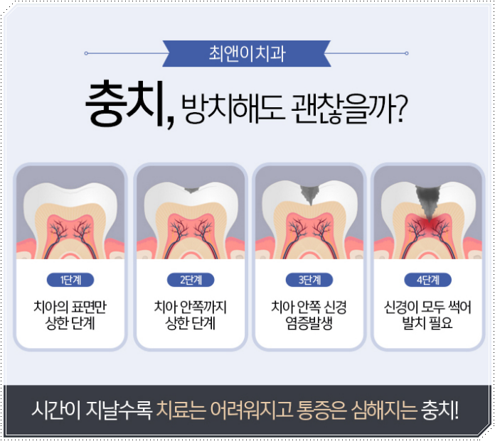 시청치과 멀면 힘들어요 관련 이미지 7