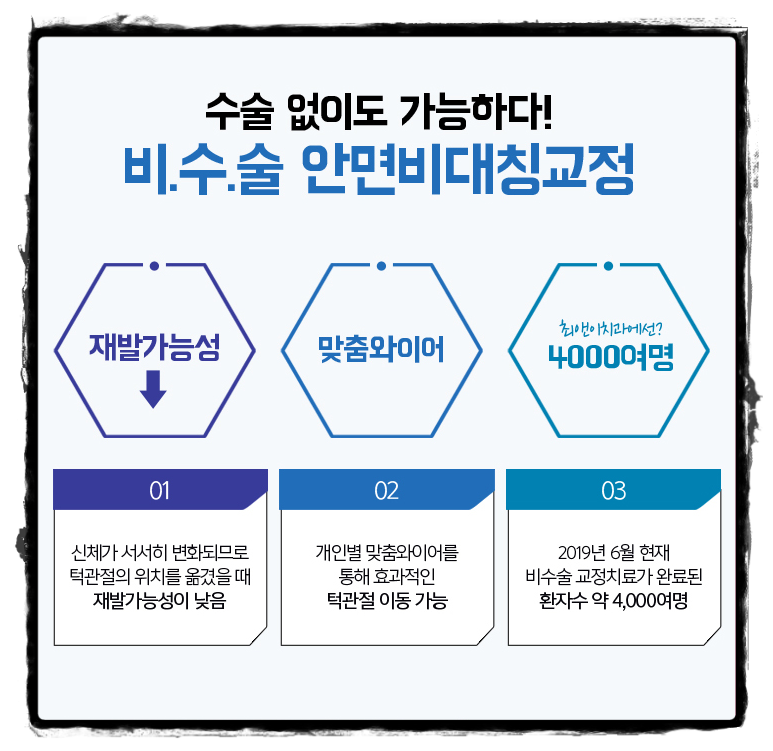 턱비대칭교정 알맞은 모습으로 바꾸자 관련 이미지 7