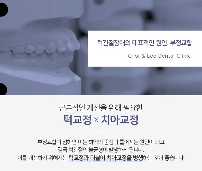 턱관절장애 미세하더라도 관련 이미지 7