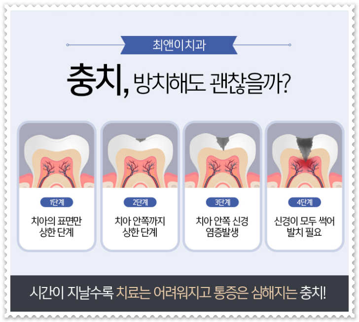명동치과 생각을 한다면 관련 이미지 7