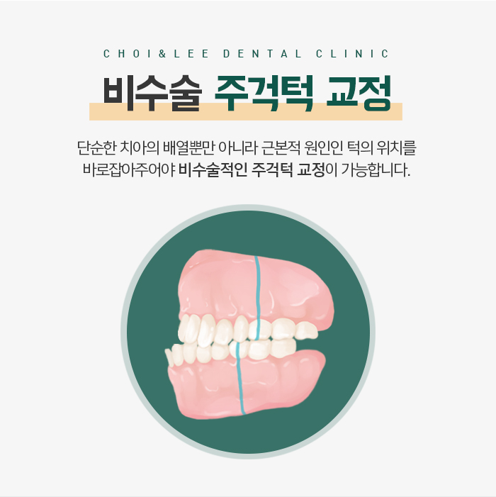 주걱턱의 정의와 증상에 대해 관련 이미지 8