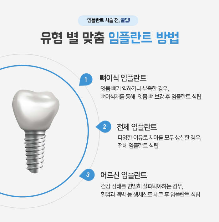 치아를 상실했을 때, 기능을 회복시켜주는 임플란트 관련 이미지 13