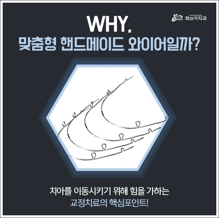 덧니부분교정 힘들지 않도록 관련 이미지 5