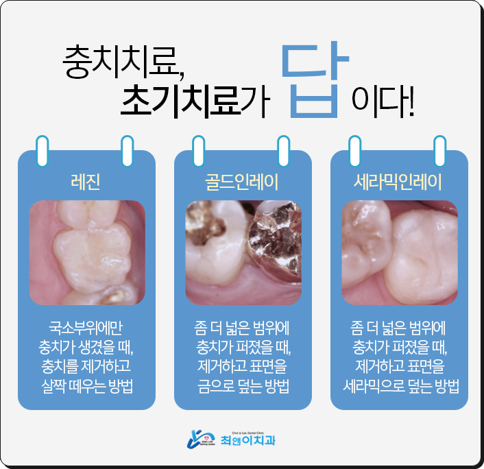 서대문역치과 알아본다면 관련 이미지 8