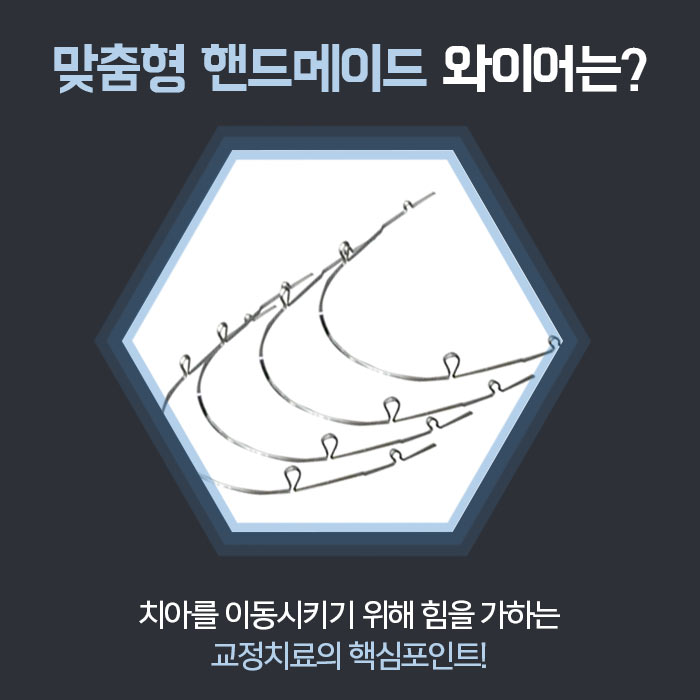 주걱턱의 정의와 증상에 대해 관련 이미지 6