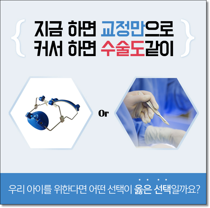 어린이주걱턱 구성부터 따져봐요 관련 이미지 3