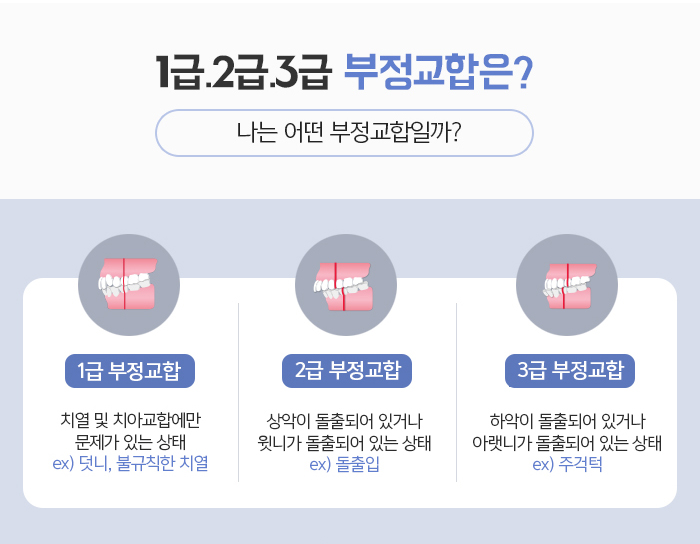 돌출입의 정의와 진단하는 방법에 대해 관련 이미지 3