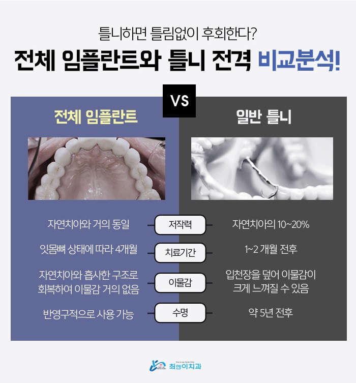 앞니임플란트가격 무엇을 봐야하나 관련 이미지 8