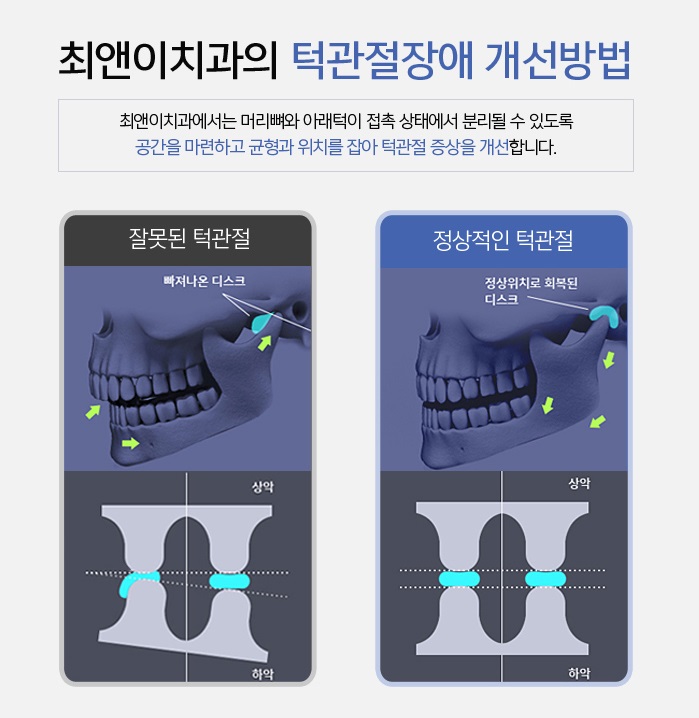 치아교정턱관절 힘들지 않도록 관련 이미지 4