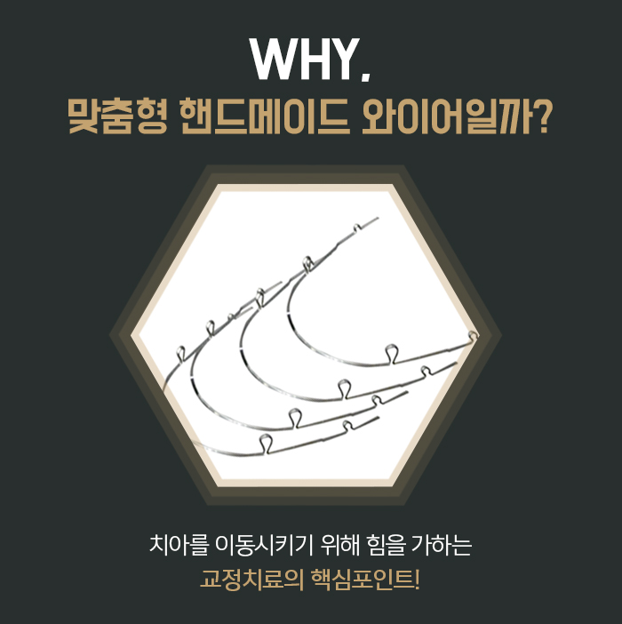 주걱턱의 정의와 증상에 대해 관련 이미지 5