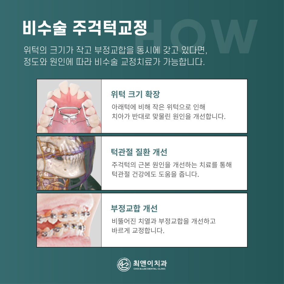 주걱턱의 정의와 증상에 대해 관련 이미지 8