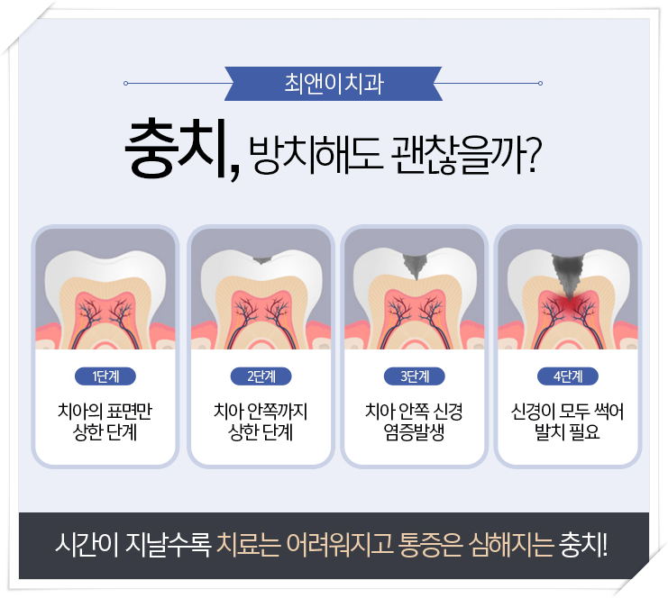 앞이빨 깨짐 허전함이 느껴지면 관련 이미지 6