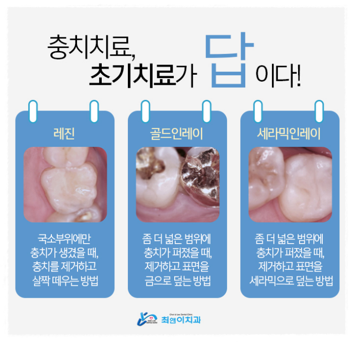 앞니부러짐 허전함이 크다면 관련 이미지 7