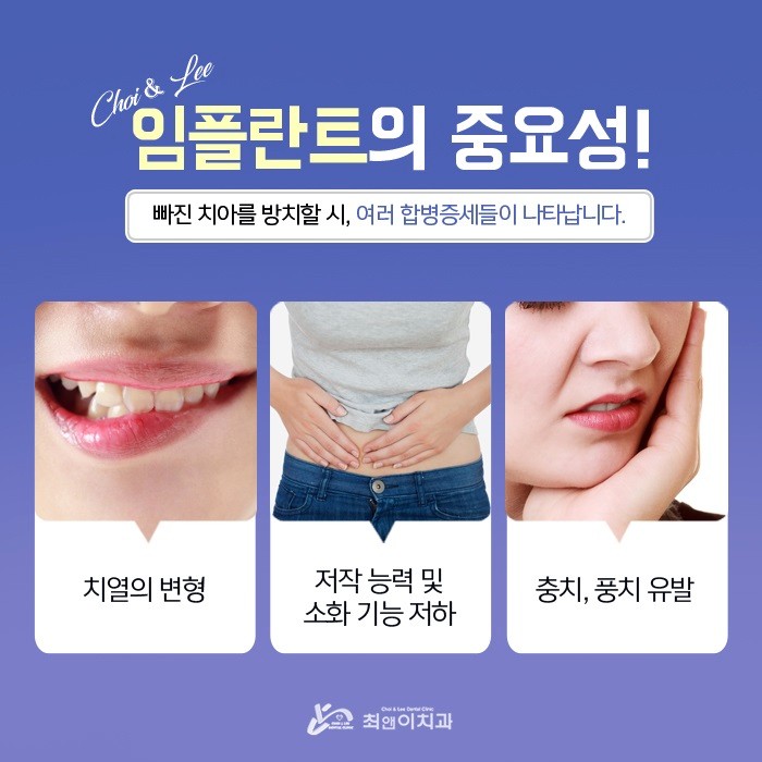 서울임플란트잘하는치과 찾아가기 위해서 관련 이미지 2