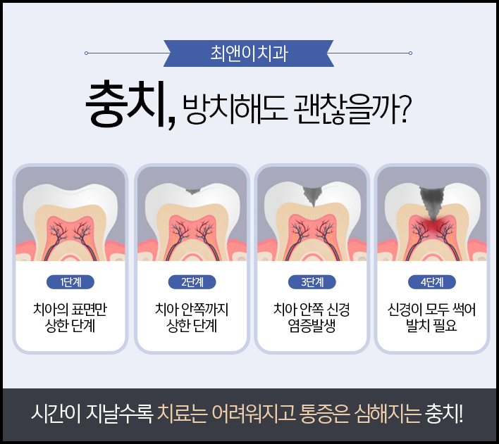 치아크라운가격 늦지 않도록 관련 이미지 6