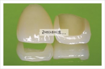 [치과계소식] 사후관리시스템의 중요성 관련 이미지 1