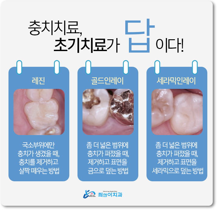 광화문역치과 간단하여도 달라야 하죠 관련 이미지 8
