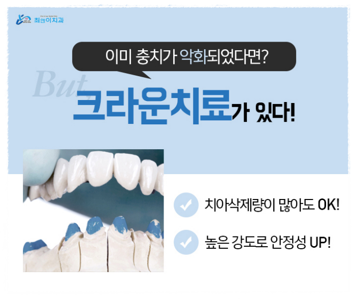 앞니부러짐 허전함이 크다면 관련 이미지 8