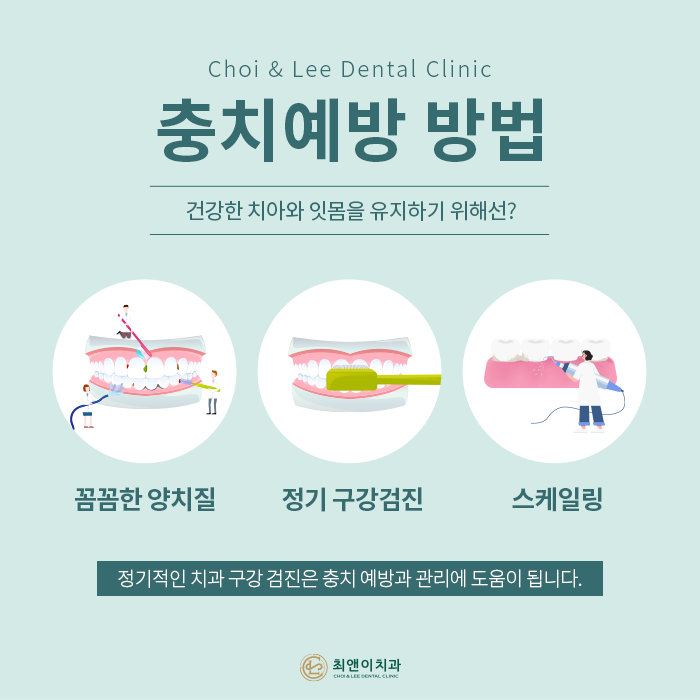 자연치아를 보존하기 위한 충치치료 방법 관련 이미지 10