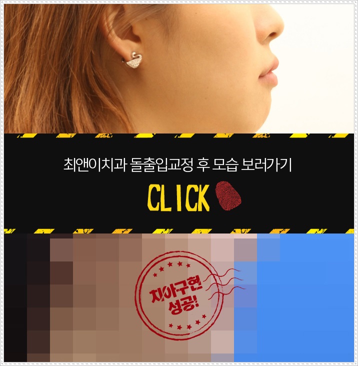 돌출입교정치과 찾아가려 한다면 관련 이미지 7