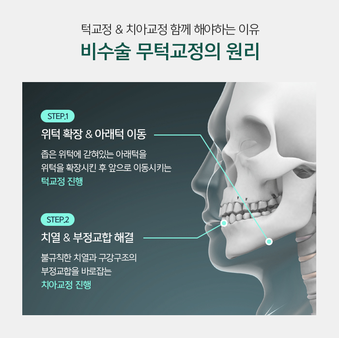 무턱 증상과 원인에 대해 관련 이미지 6