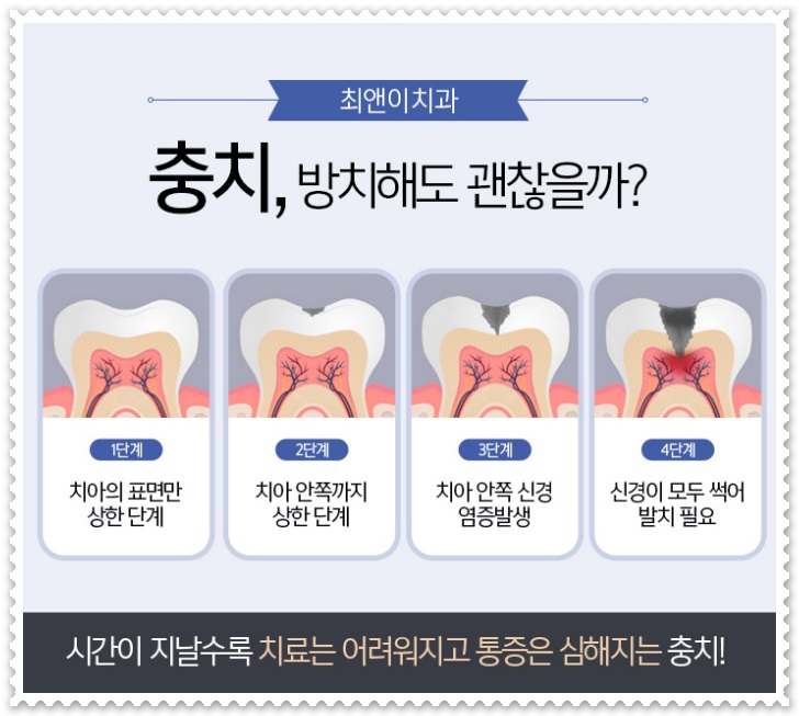 깨진 앞니 방치해도 괜찮을까? 관련 이미지 3