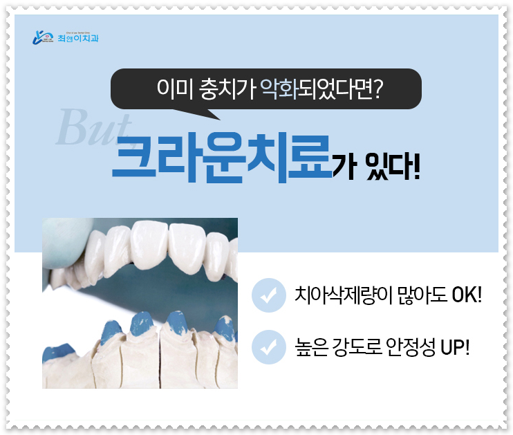 앞니깨짐 걱정이 된다면? 관련 이미지 11