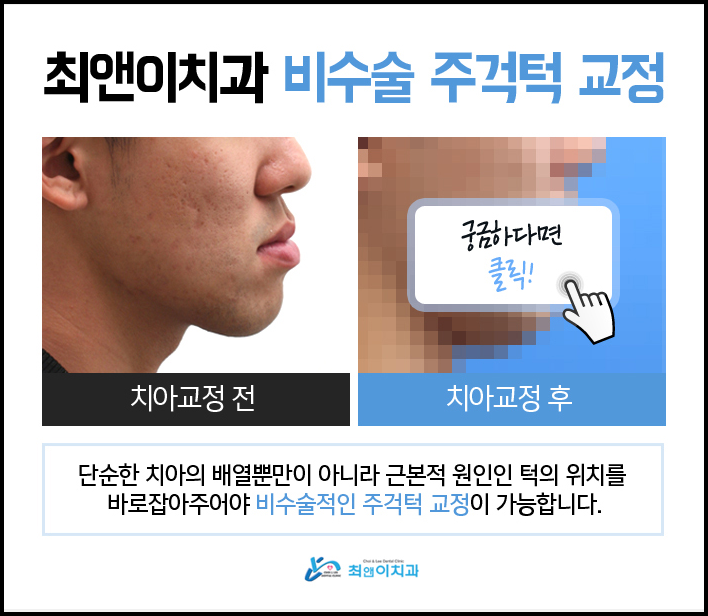 부정교합턱관절 이상 증세가 보인다면 관련 이미지 4