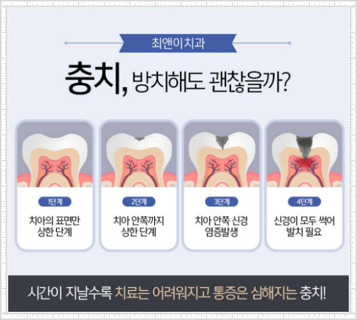 치아보존치료 늦으면 힘들어져요! 관련 이미지 6
