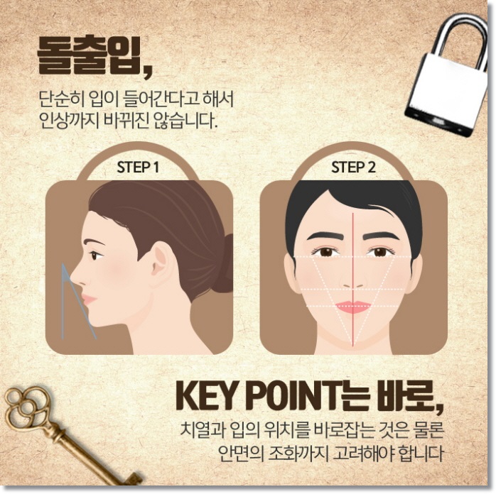 잇몸돌출교정 당황스럽지 않으려면 관련 이미지 6