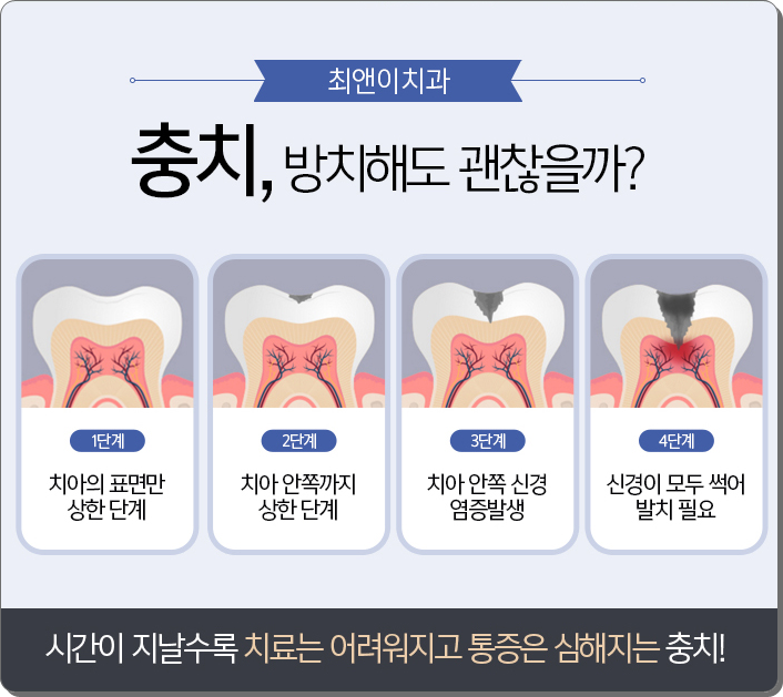 광화문치과추천 힘들어 하기보다 관련 이미지 7