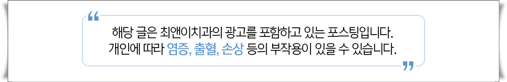 비수술주걱턱교정 힘들지 않고자 하려면 관련 이미지 19